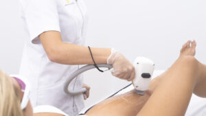 zones corporals preferides depilacio laser