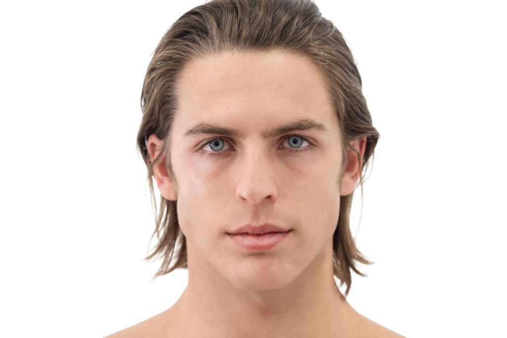 depilacio laser masculina facial - laser factory